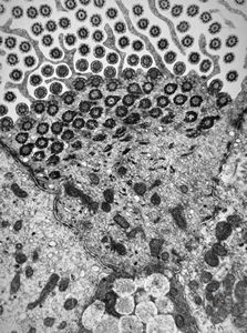 M,22y. | normal bronchial epithelium